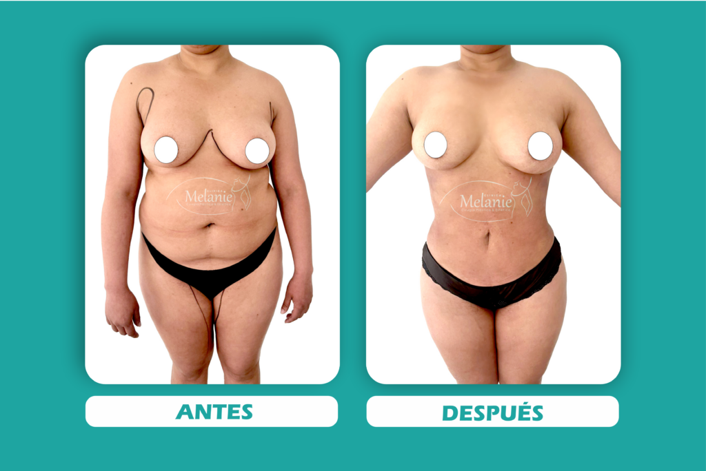 IMAGENES 2